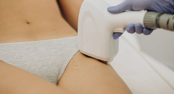 Depilación Láser Definitiva